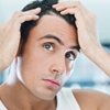Queda de cabelo: dá para disfarçar
